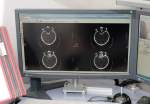 d180507-111236-160-100-schlaganfall-experten_mit_heli_zum_patienten