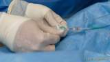 d180507-123420-140-100-schlaganfall-experten_mit_heli_zum_patienten